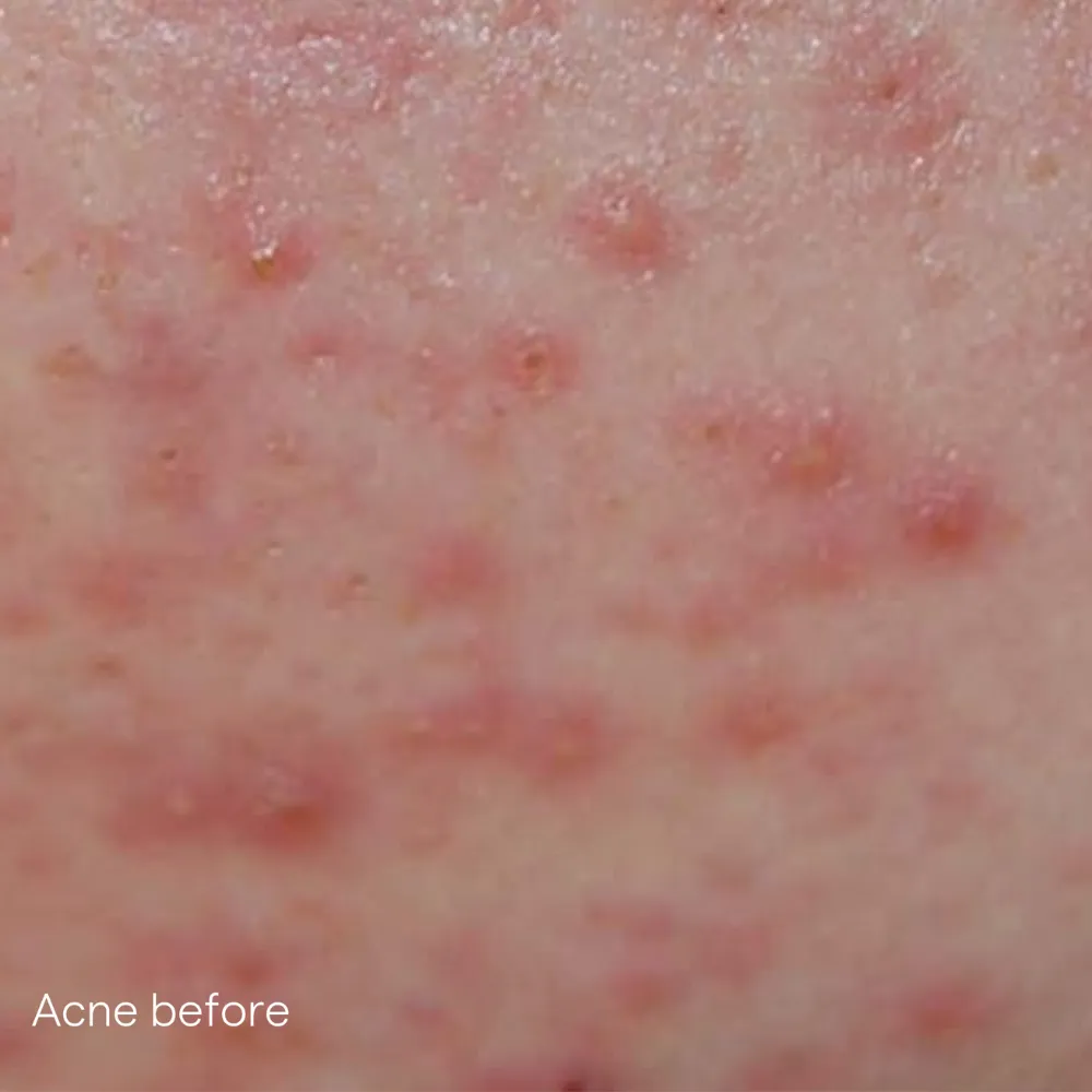 iS Clinical Active Serum